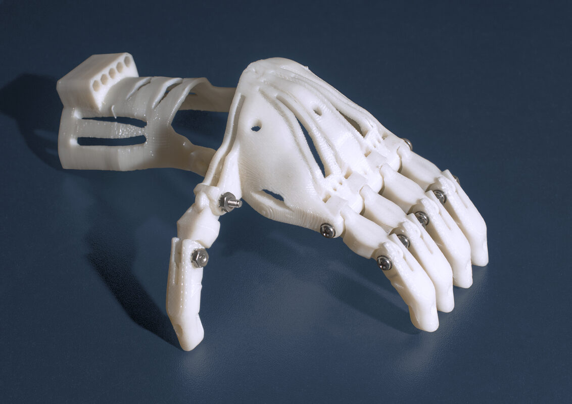 No Batteries, No Motors: Queen's University Students 3D Print an Elbow-to-Fingers Prosthetic for the Thailand-Myanmar Border