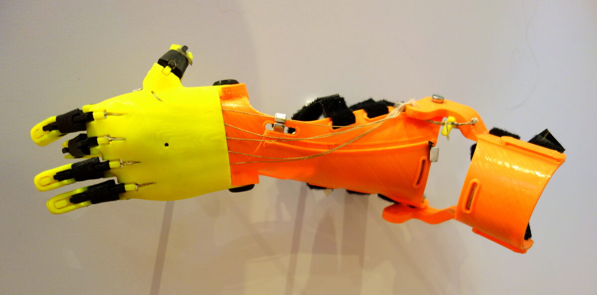 Queen's University Students Open-Source a Battery-Free 3D-Printed Prosthetic Arm for Refugees on the Thai-Myanmar Border