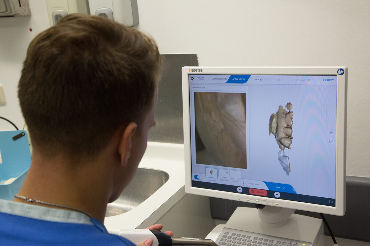 SprintRay's Midas Restore Packs 75% Ceramic-Zirconia Filler Into a Chairside 3D-Printable Crown Material